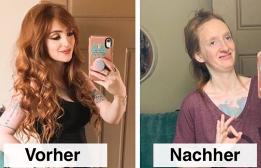 Vorher-nachher-Bilder: Frauen zeigen schönste Grimassen